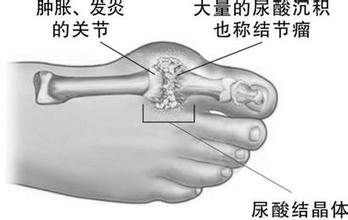 ʹL(fng)ίṩĵʹL(fng)ί 
P(gun)I: